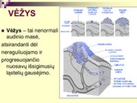 Skaidrės apie vėžį 2