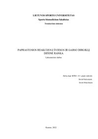 Paprastosios reakcijos į šviesos ir garso dirgiklį dešine ranka 1
