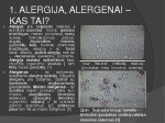 Alergija Alergenai Alergija maistui 3