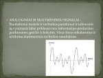 Anologinis ir skaitmeninis signalai 2