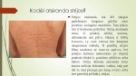Strijos nėštumo metu 3