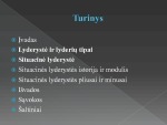 Situacinės lyderystės teorijos, jų esmė, raida 2