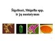 Šigeliozė nustatymas