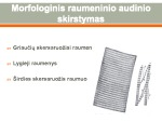Raumeninis audinys 3