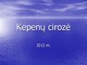 Kepenų cirozė