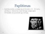 Šizofrenija medicinos projektas 3