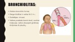 Bronchitas: ligos eiga ir gydymas 3