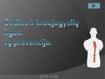 Širdies ir kraujagyslių ligos, Jų prevencija 1