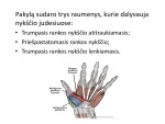 Nykščio pakylos atrofija 2