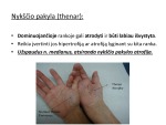 Nykščio pakylos atrofija 3
