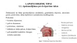 Apsinuodijimas alkoholiu 3