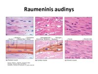 Skaidrės apie raumeninį audinį 2