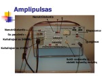 Fizioterapijos aparatai 3