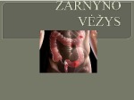 Žarnyno vėžys 1