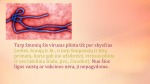 Ebola 3
