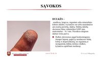 Dulkių skirstymas Dulkėtumo mažinimo principai, jų valymas 2